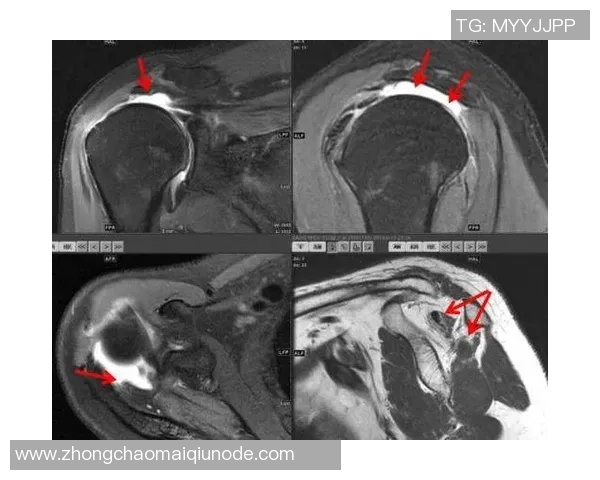 约维奇重摔受伤退场X光检查结果无异常明日将进行MRI检查评估伤情